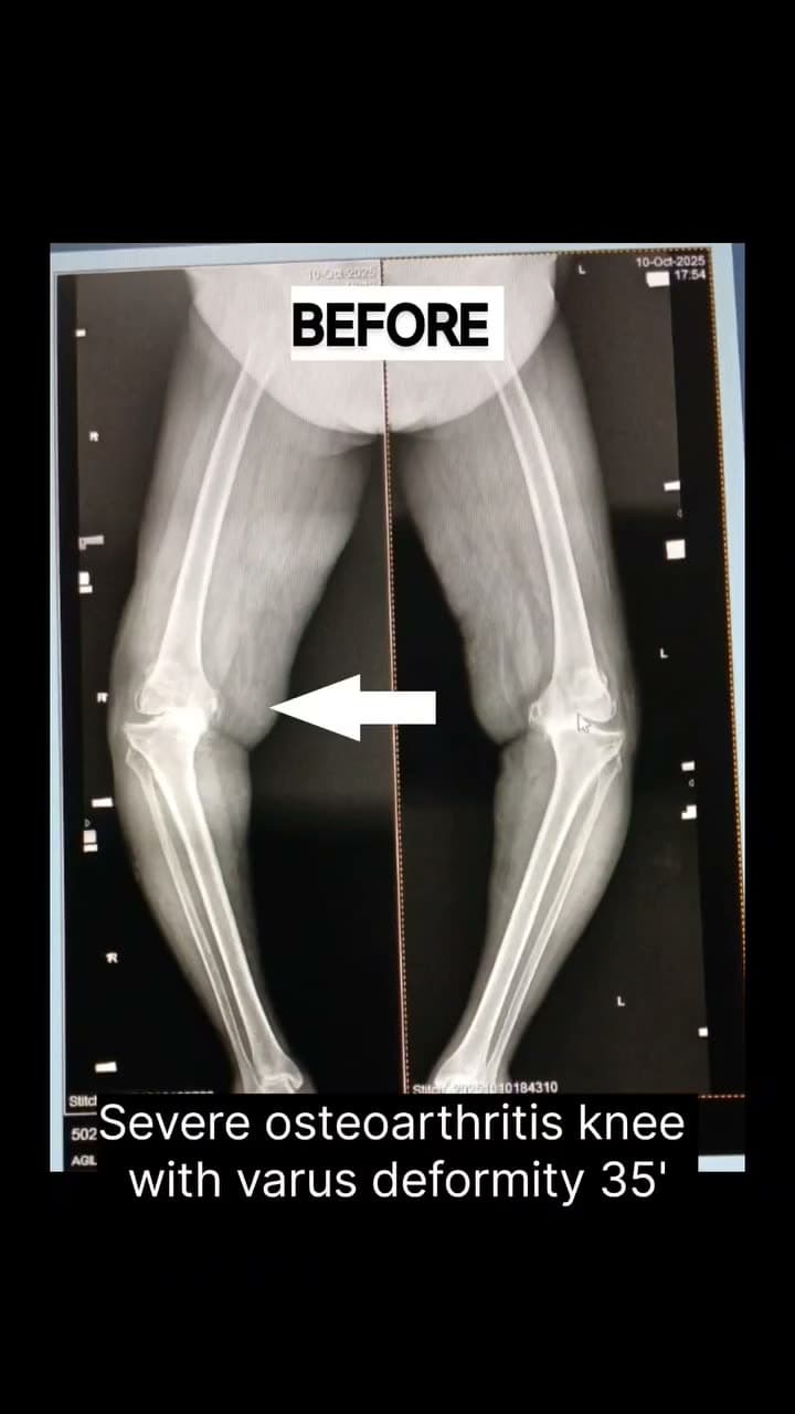Patient story 6